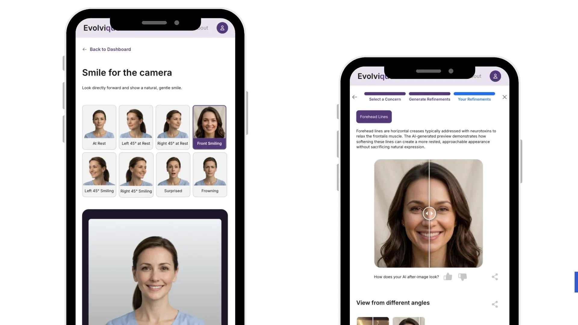AI-Powered Treatment Previews | Evolvique